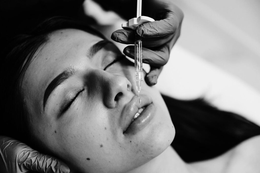 naa-bw-cosmetologist-does-injection-for-lips-augmentation-2025-03-18-20-22-14-utc