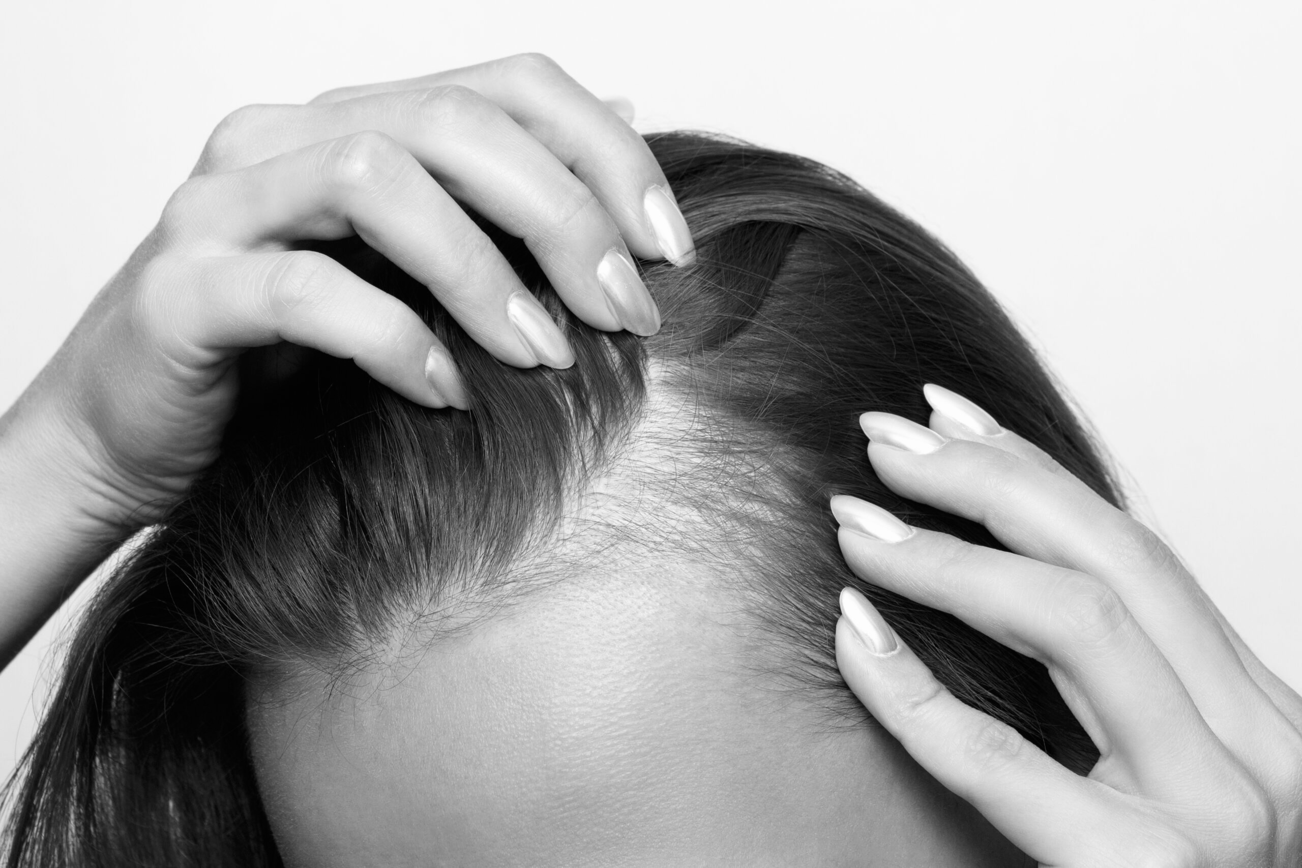 From Roots to Renewal – The Hair Loss Course